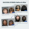 Before and after Micro-Infusion treatment: 6 customers showing visible hair regrowth