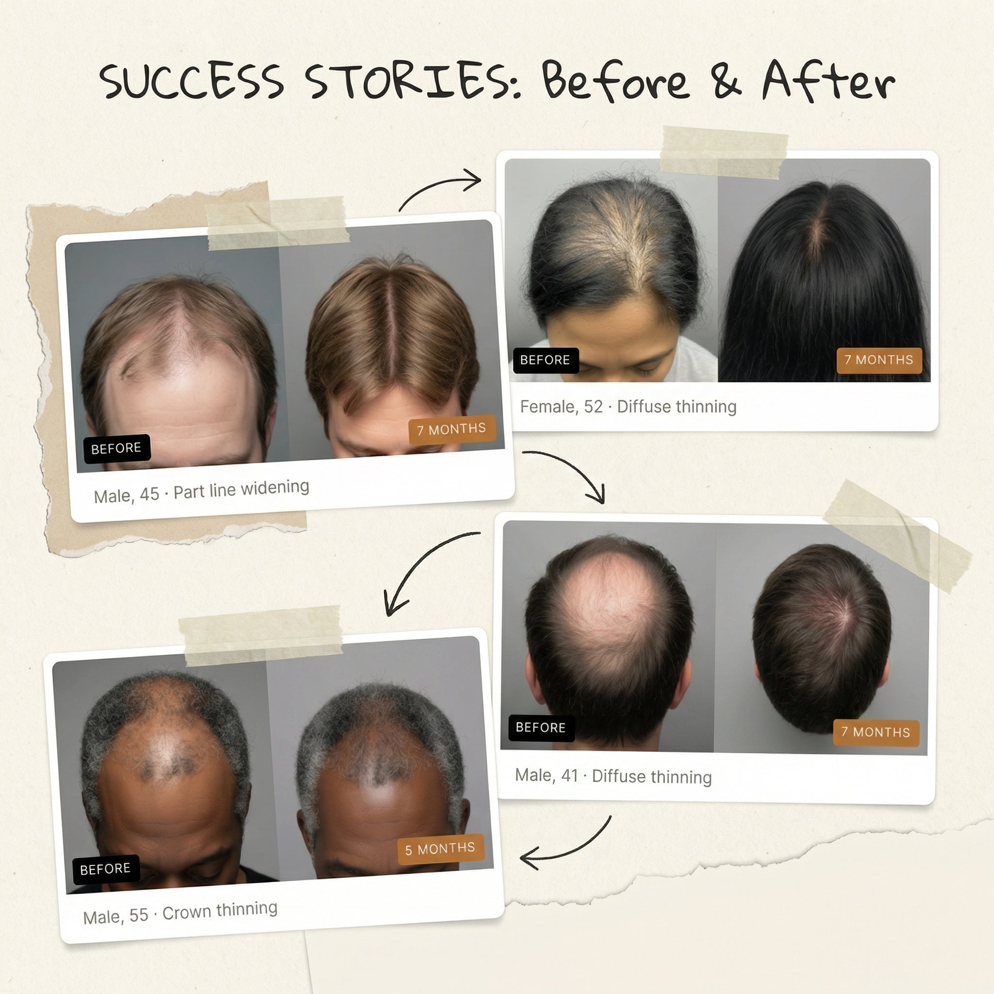 Follicle Activation Protocol product