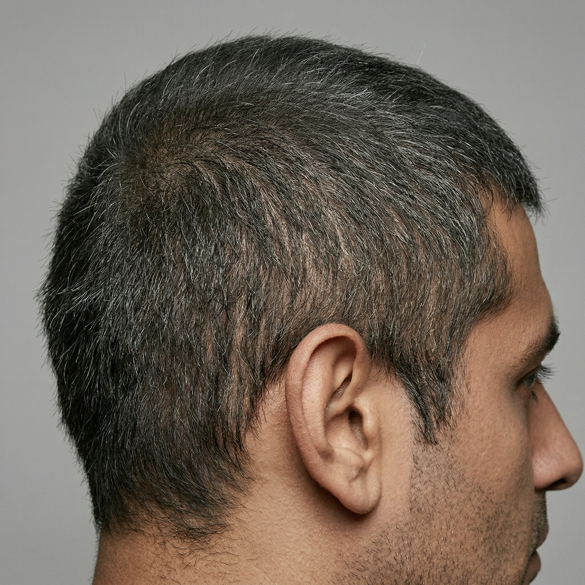 Results — Michael R.