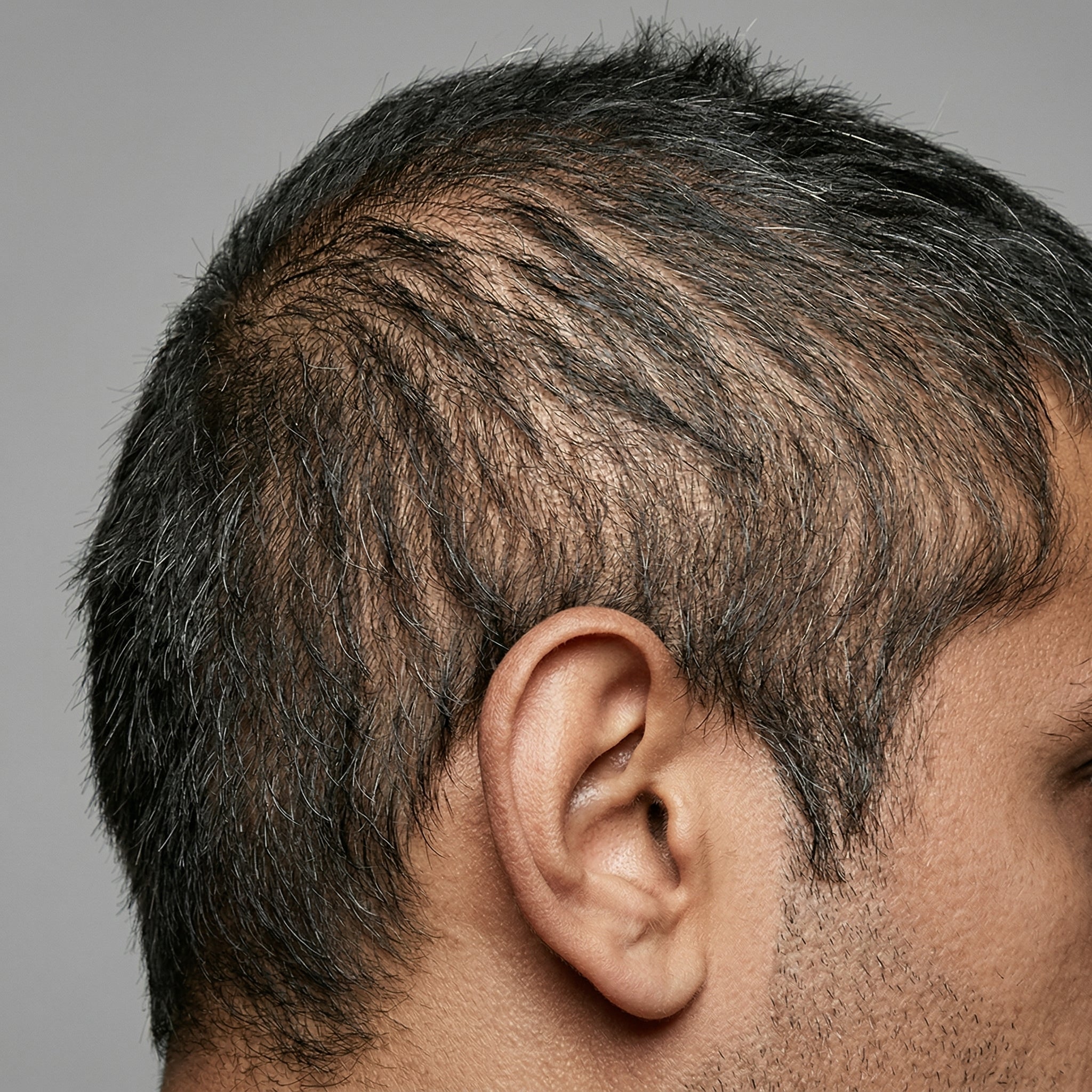Before — Michael R.