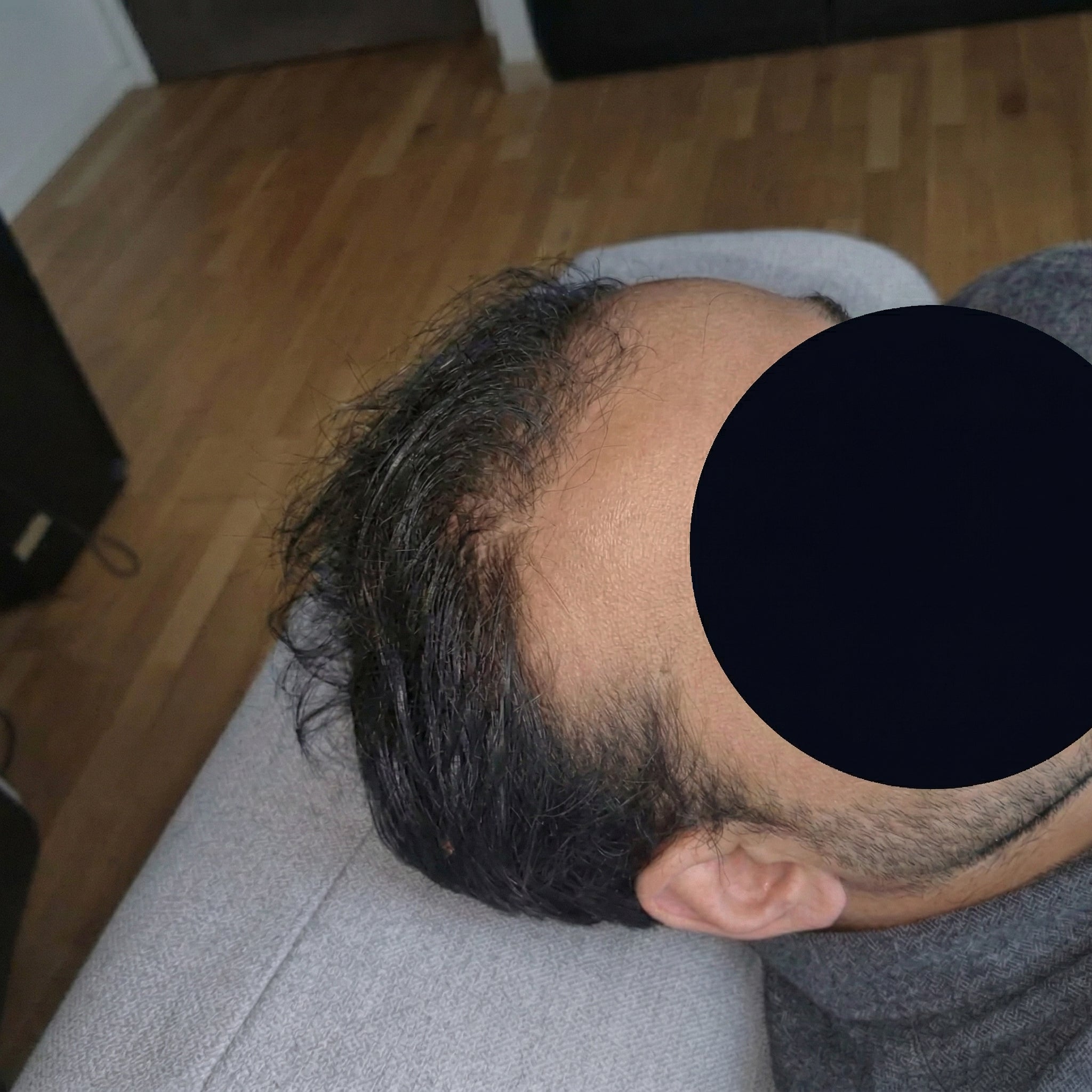 Before