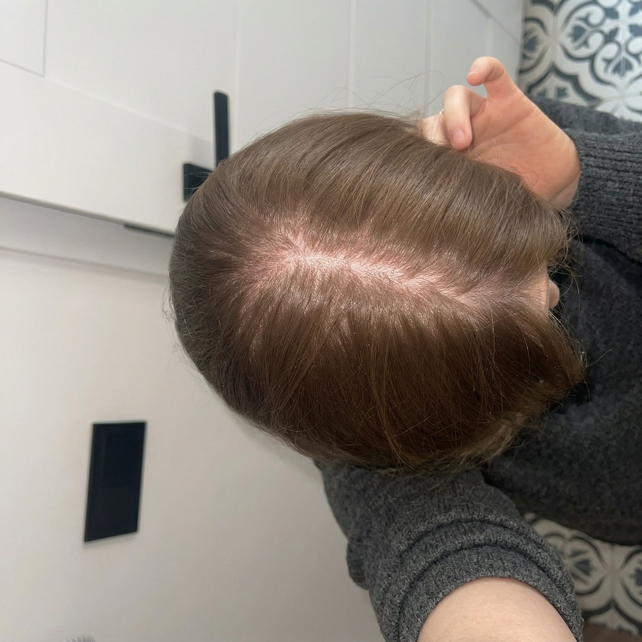 Before — Emma W.