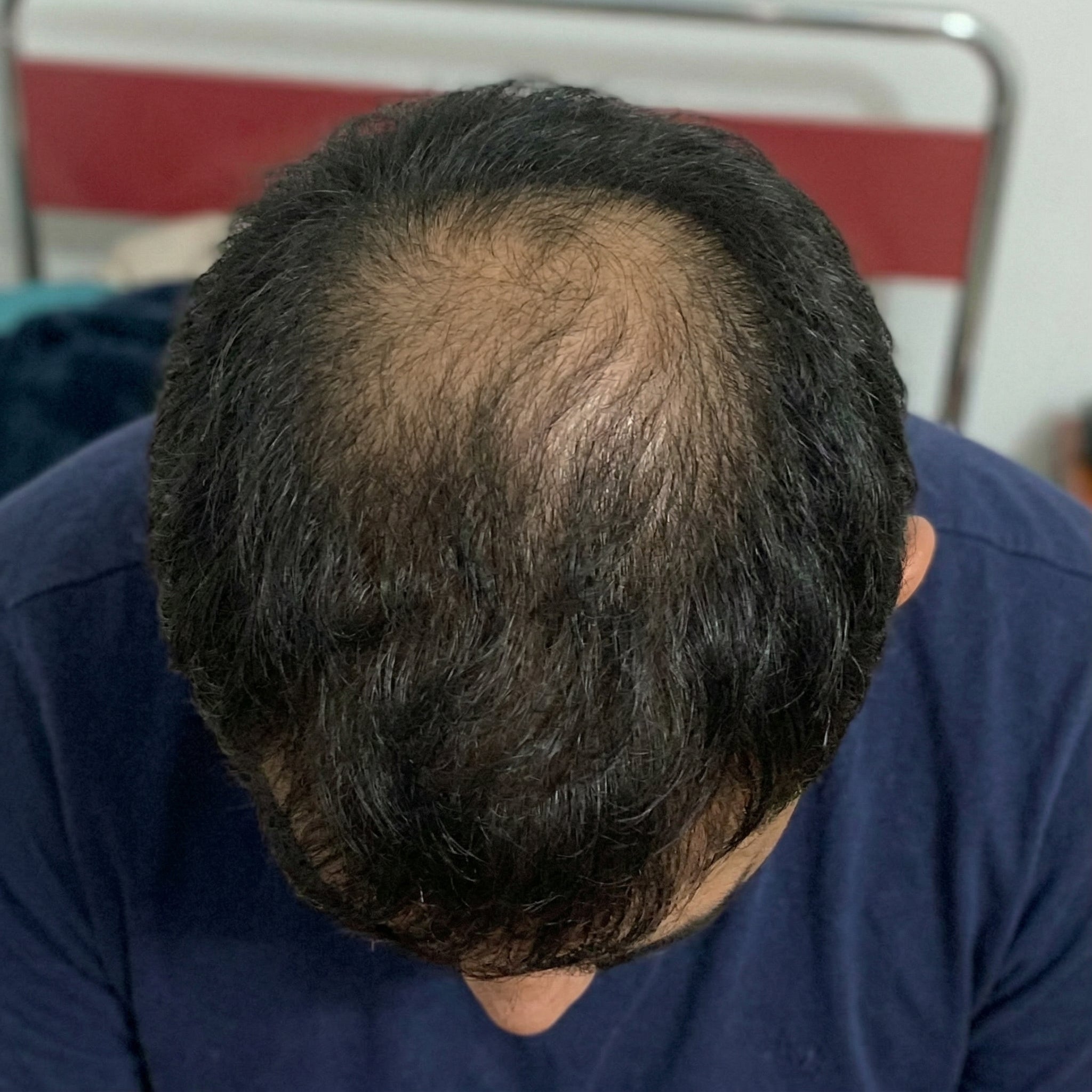 Before — David L.