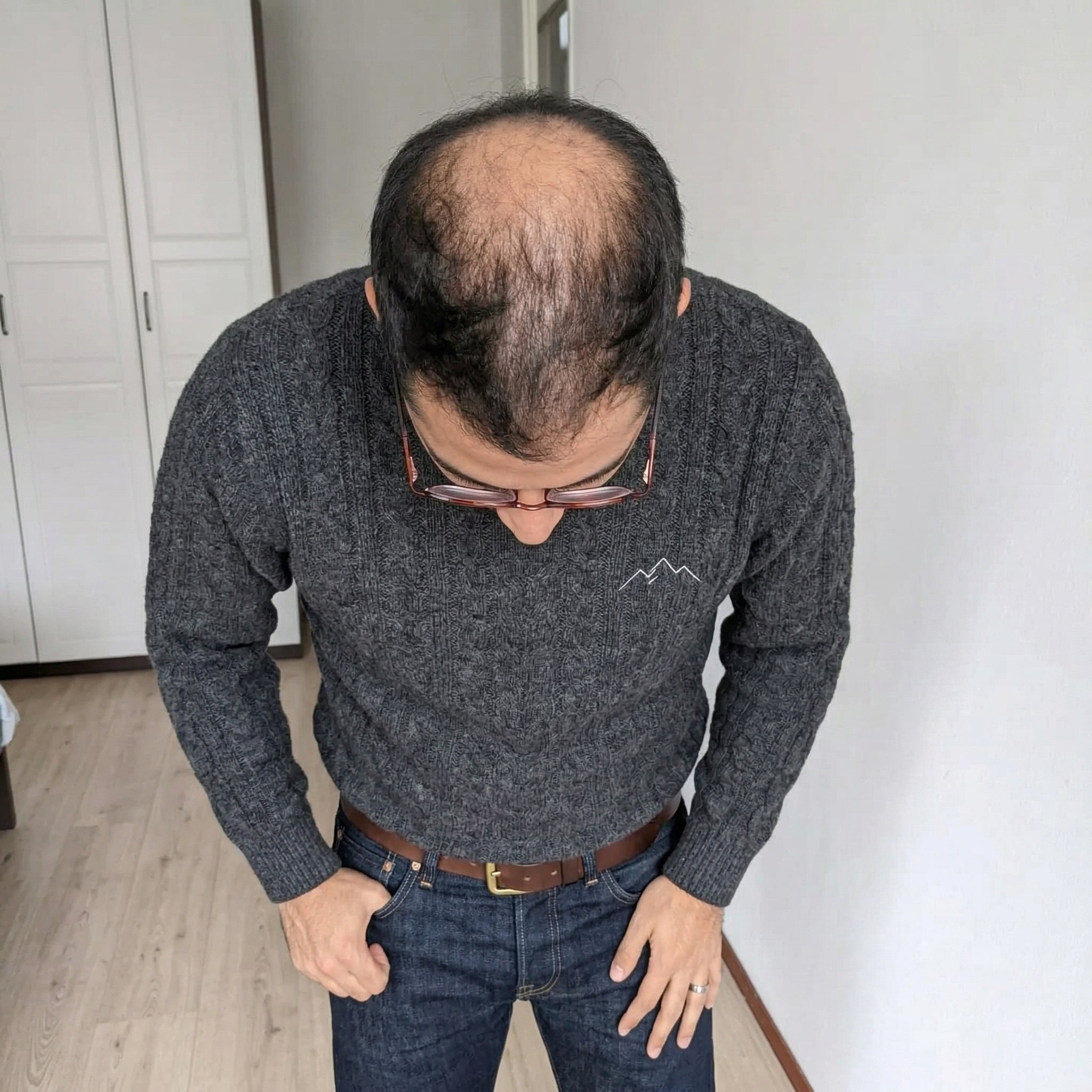 Before — James T.