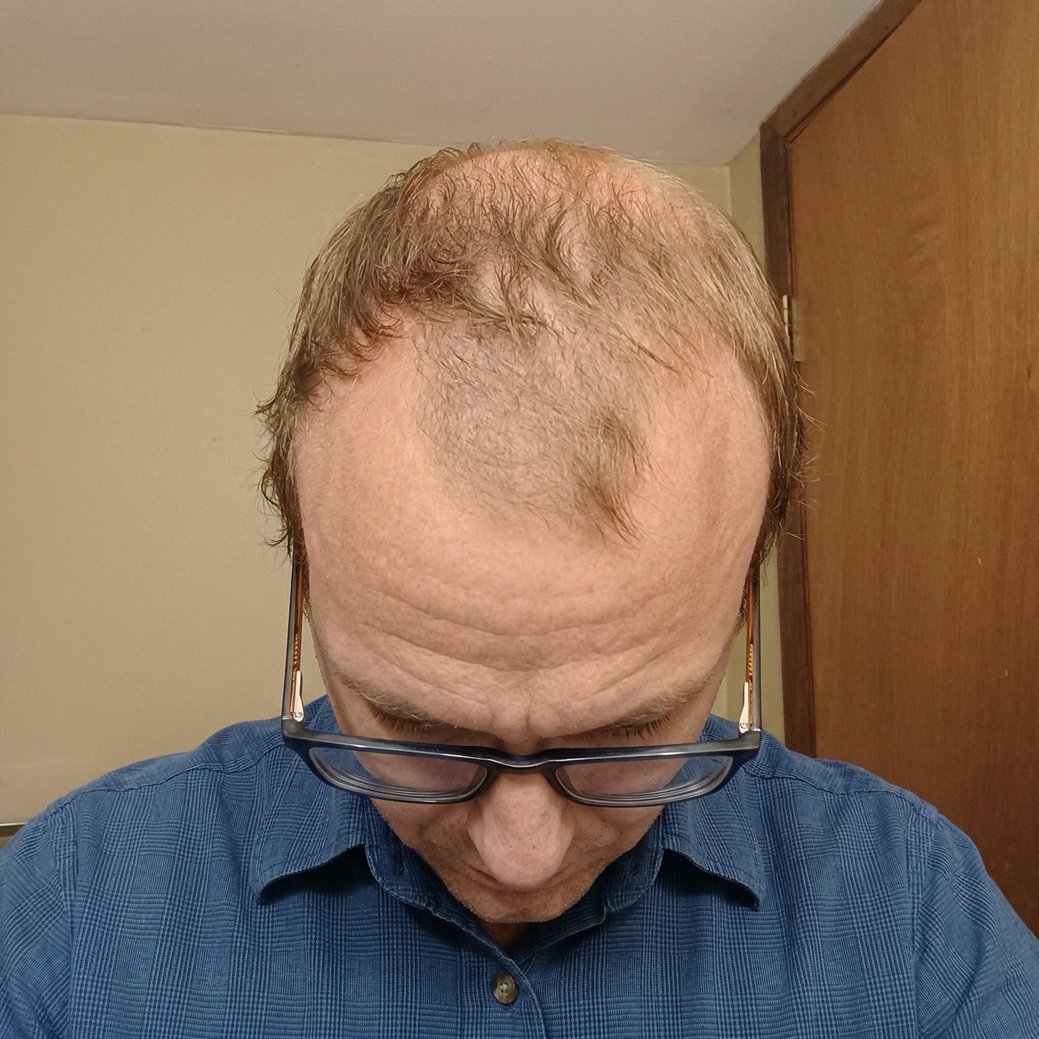 Before