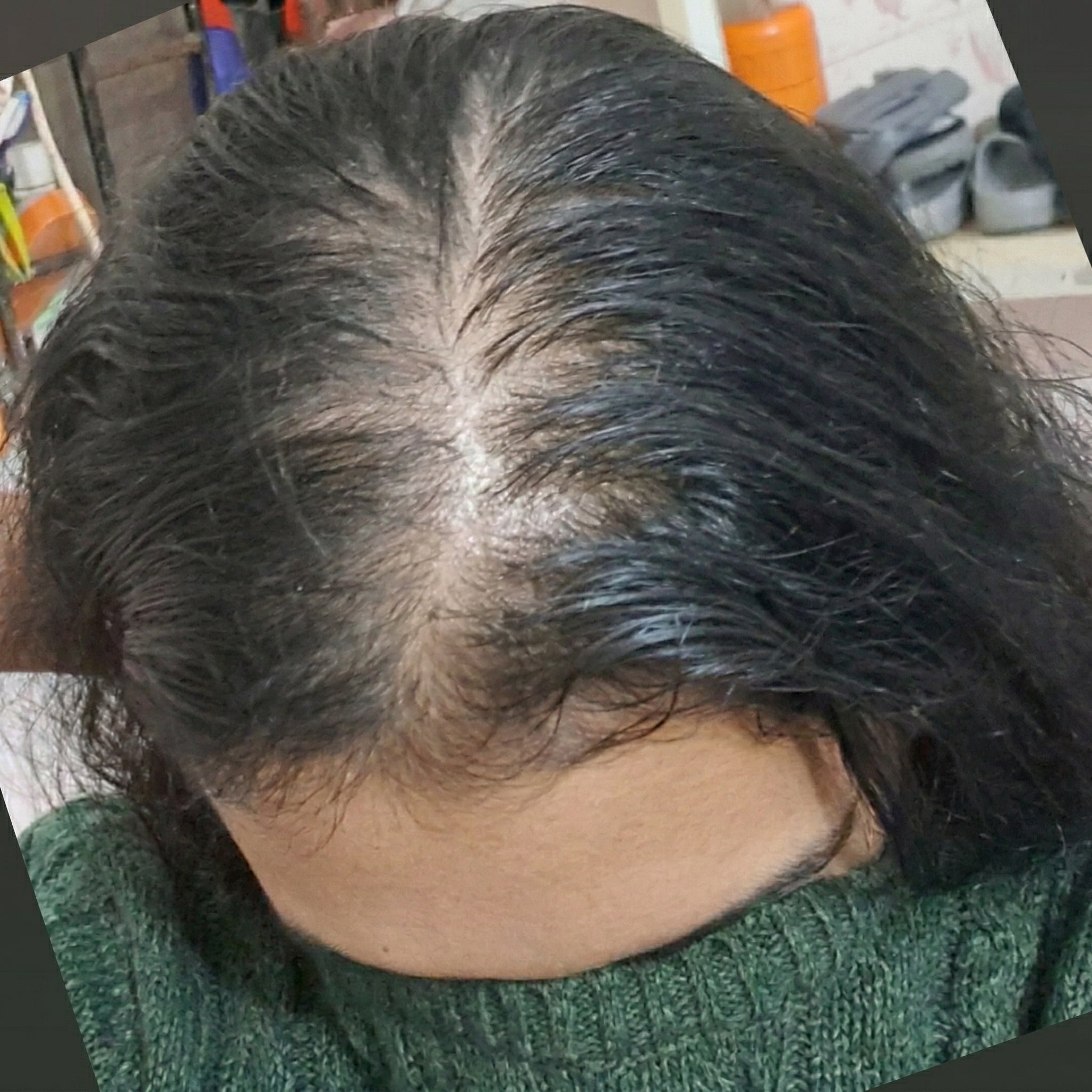 Before
